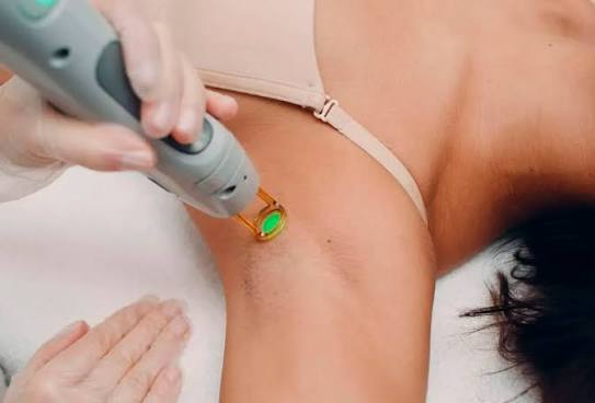 Depilação a Laser